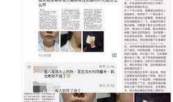 绵阳医美爆料事件视频最新
